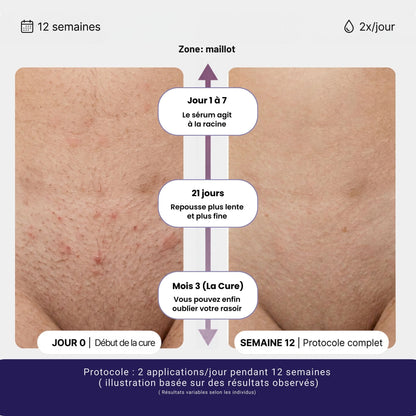 Sérum Anti-Repousse